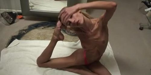 Anorexic Milf Inna Tnaflix