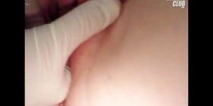 kでの女性化乳房のヘルガgyno猫検鏡検査