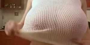 Marilyn Sakova'S Huge Boobs B4 Breast Reduxion