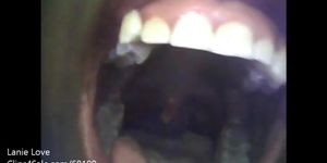 black uvula