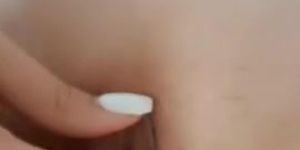 Stretched pussy lips