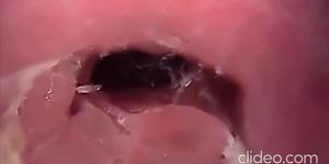 SHOT INSIDE ASS HOLE (INTERNAL ANAL CREAMPIE)