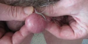 pain balls dick ring