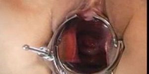 Stretching Out Gaping Pussy Meat with a Speculum