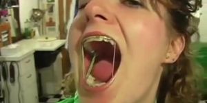 Mouth/Tongue fetish hot girl braces with elastics