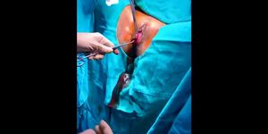 The surgeon treats the patient hymen