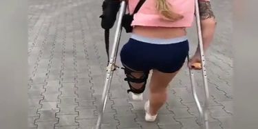 amputee cam girl TNAFlix Porn Videos