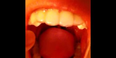Asian Girl Gagging Herself (and slightly showing her epiglottis ...