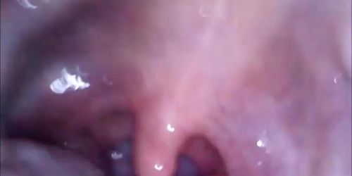 Cam in mouth vagina and extreme ass closup