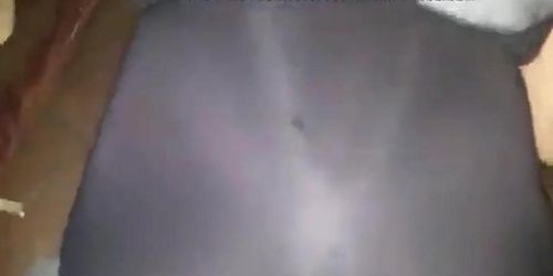 Dark nipples