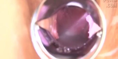 Some kinky japanses first gyno exacmination - Tnaflix.com
