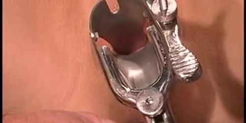 Doctor inserts speculum into hot c-bowl light-haired's greased twat