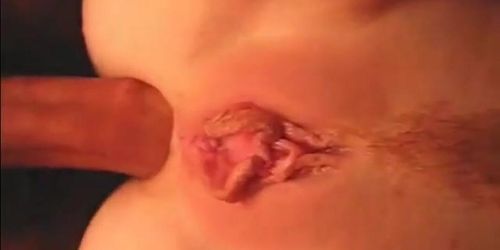 First Anal