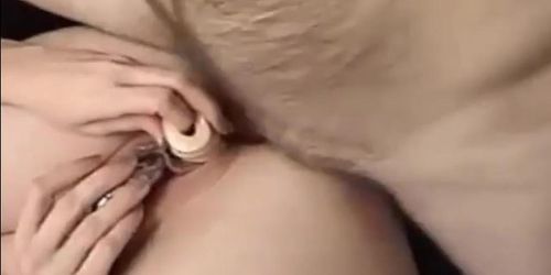Anal diolido