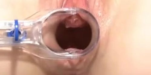 18 y/o's Vagina Masturbation with Speculum