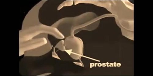 How to give a prostate massage