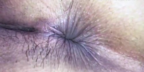 HAIRY ASSHOLES FART, COMPILATION, EXTREME CLOSEUPS