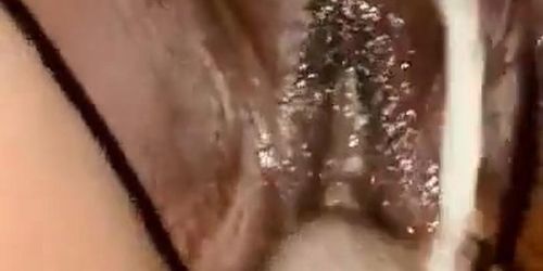 Sexual Eruption