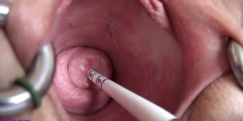 Solo Cervix Close Up.mp4