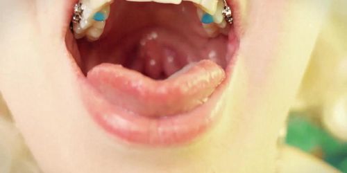 Eating In Braces - Food Fetish - Vore Video - Mouth Tour