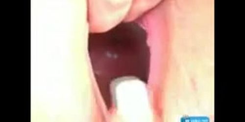 huge gapes
