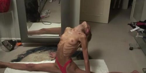 AnorexicLovers - Inna 13