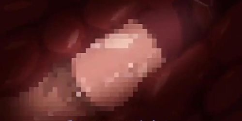 hentaiecci