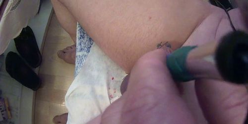 cbt insertion needles extrem 2