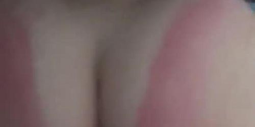 clapping big white ass sunburnt