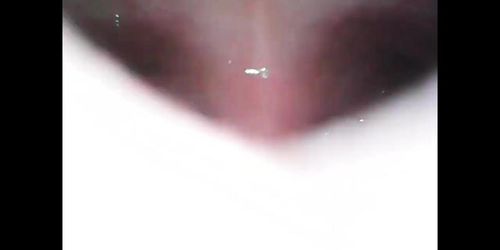 Endoscope Stomach Vore Vid - Tnaflix.com