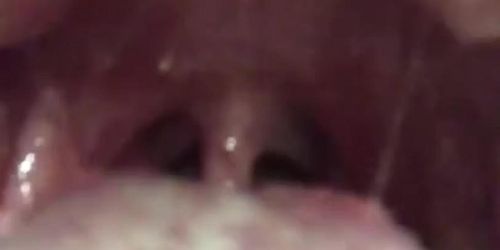 Gf throat