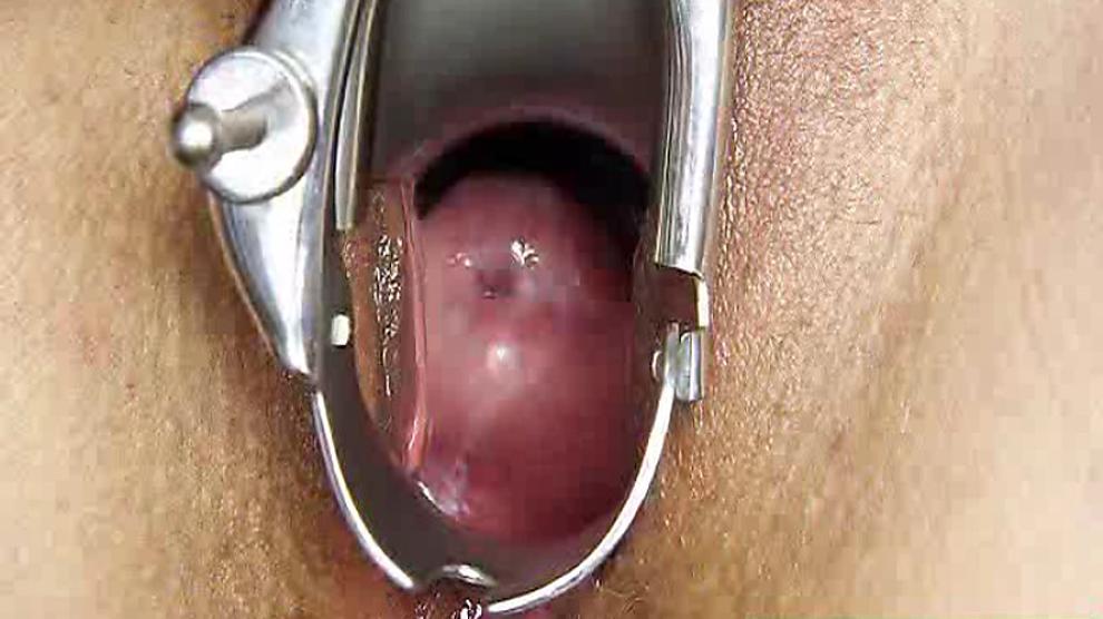 Redhead Madam Internal Piss Hole Medicaltool Exam Porn Videos