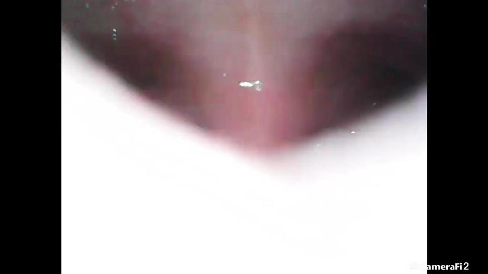 Endoscope Stomach Vore Vid Porn Videos