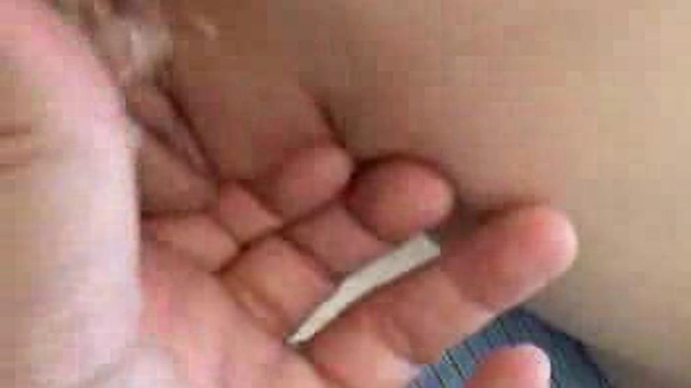 Cum On Young Girl Braces Porn Videos