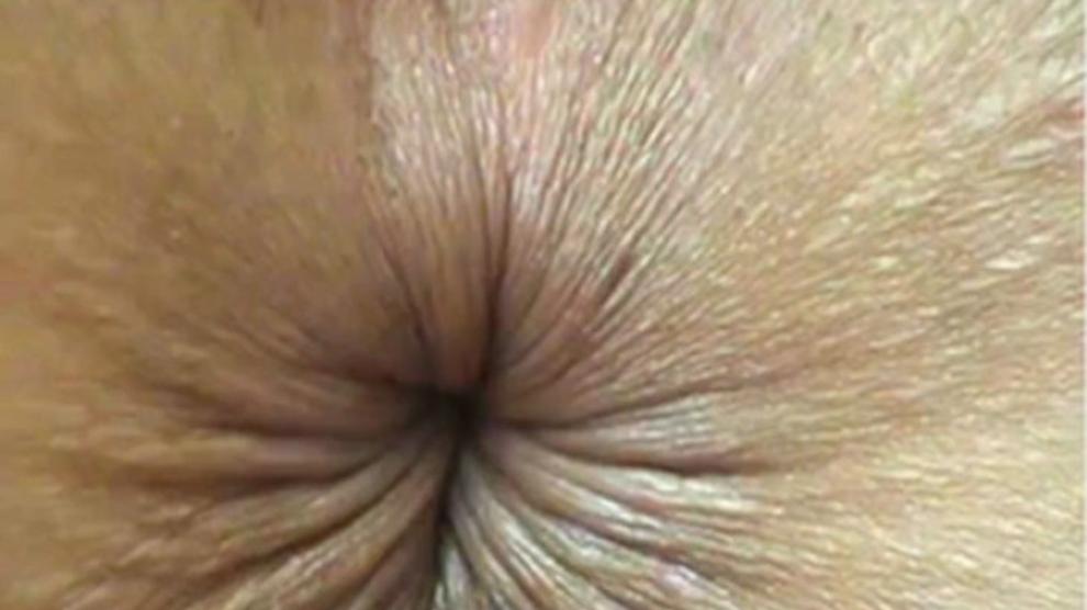 Close Up Butthole Winking Video 2 Porn Videos