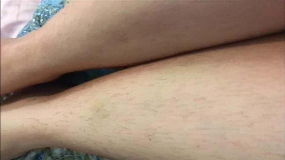 Pale Italian Girl Showing Off Lots Of Long Black Leg Hair Hairy L