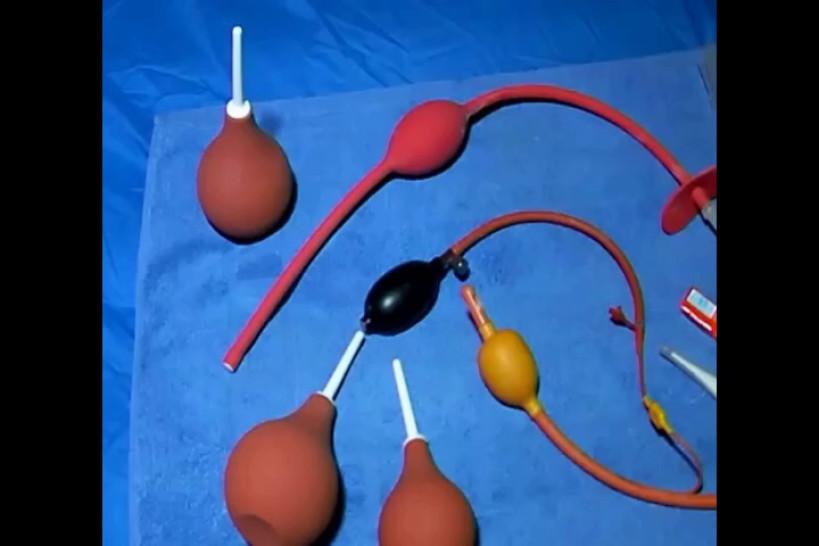 Cutouts Treatment with enemas and rectal enema with balloon rectal tube