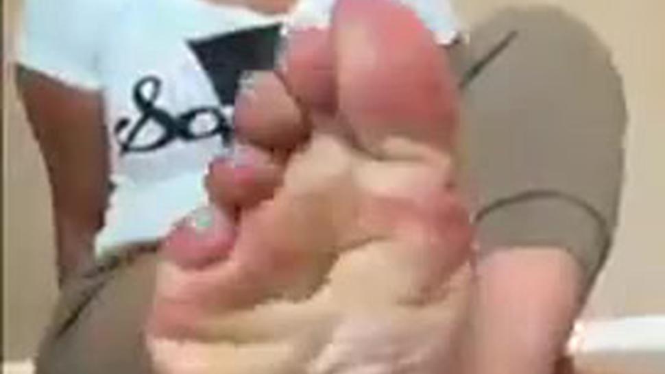 Ebony wrinkled soles and toe cracking