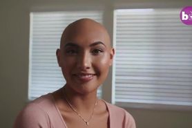 elegance of alopecia