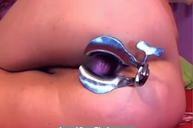 Cam Girl Anal Speculum by MDF - video 1