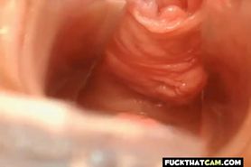 pussy close up and speculum  - video 1