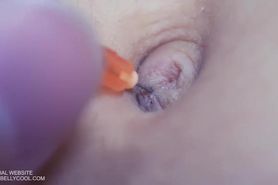 Long needle in Ting's belly button