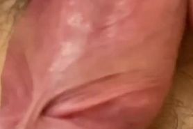 Close up dick urethra