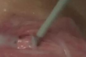 Peehole Stretching, Day One, Cum So Rough
