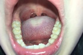 Korean girl mouth and uvula 8
