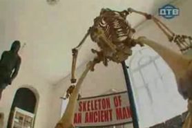 What a skeleton HAHAHA so funny
