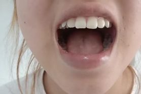 Chinese girl uvula