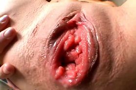 The Gape