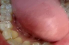 Sharada - teeth close up