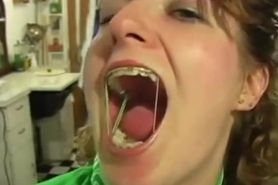 Mouth/Tongue fetish hot girl braces with elastics